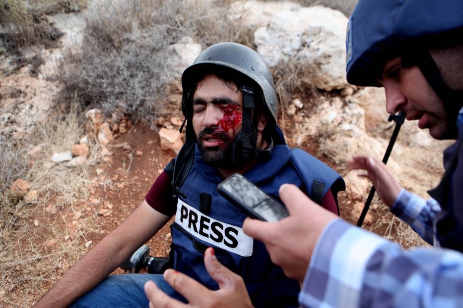 Journo wounded15