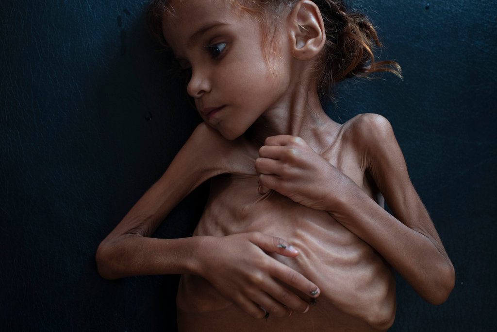 ООН: «Миллионы детей Йемена страдают от войны»