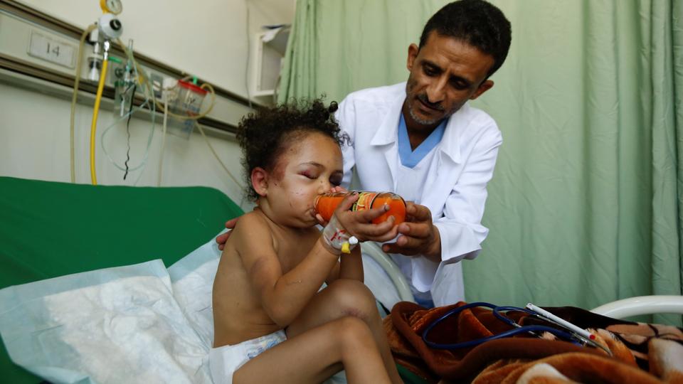Десятки тысяч йеменских детей умерли от голода