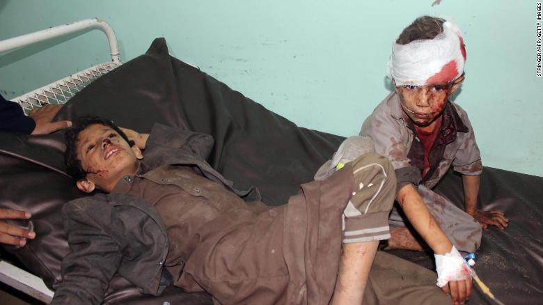 Число погибших в Йемене превысило 60 тысяч человек