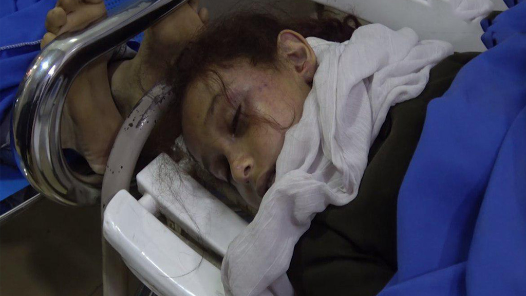 Неправительственная организация ACLED подсчитала потери среди мирных йеменцев