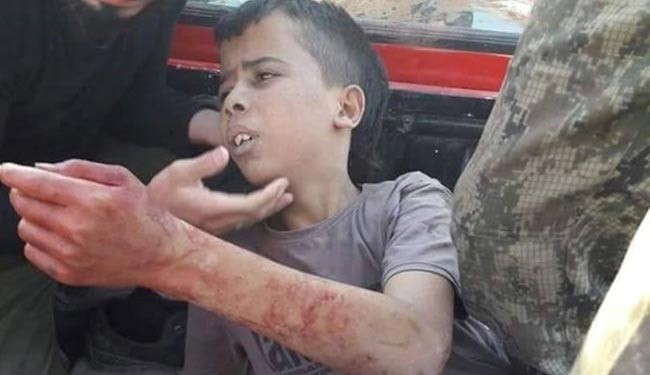 Алеппо: такфиристы отрезали голову ребенку