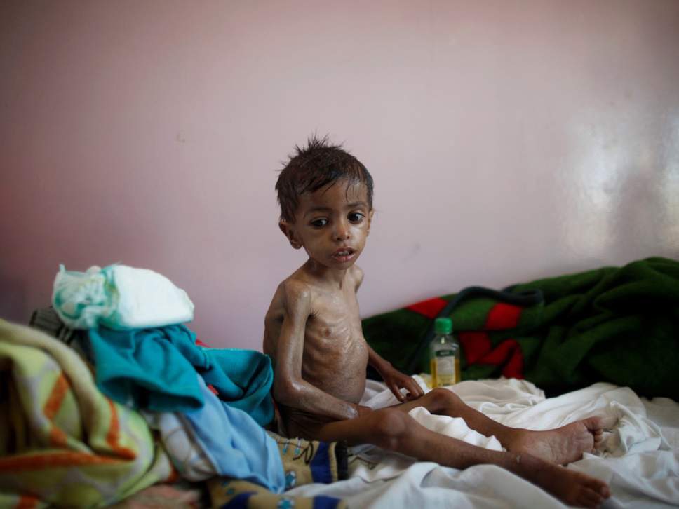 Дети Йемена страдают от насилия и психологических травм