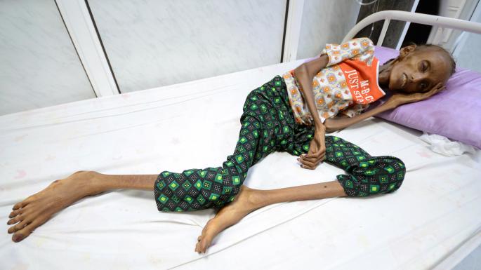 Более половины жителей Йемена голодают