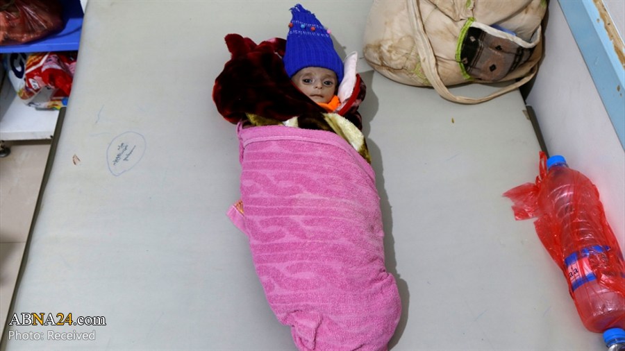 ООН: Каждые 2 часа в Йемене умирает одна беременная и шесть новорожденных